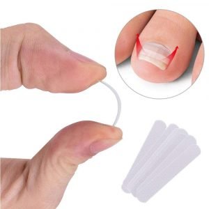Ingrown Toe Nail Correction Sticker