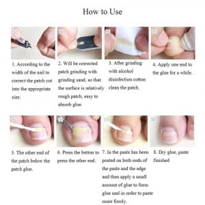 Ingrown Toe Nail Correction Sticker