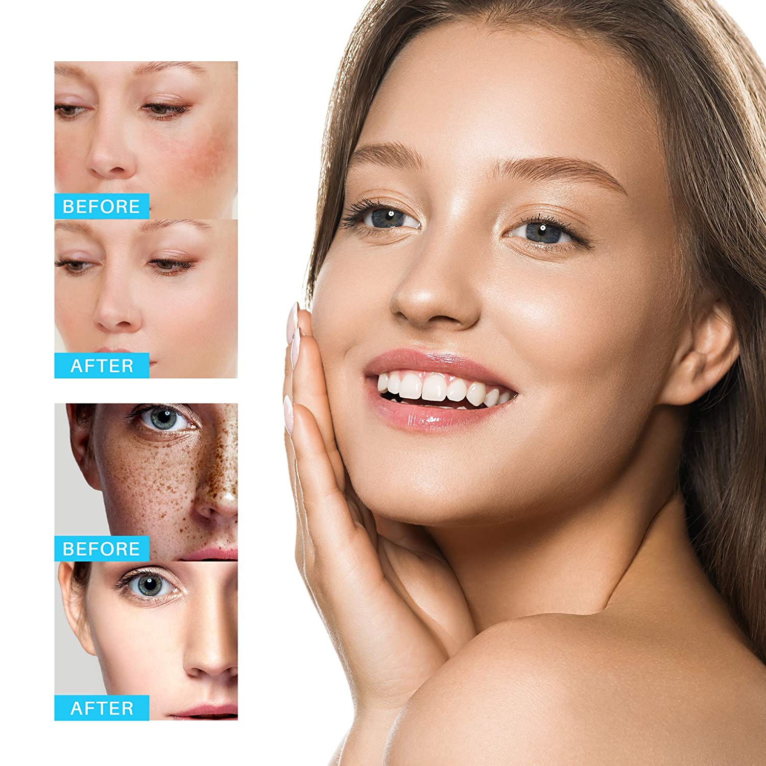 Freckle Cream Moisturizing Anti-Aging Remove Dark Spots