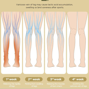 Reliefwave Smart Leg Massager