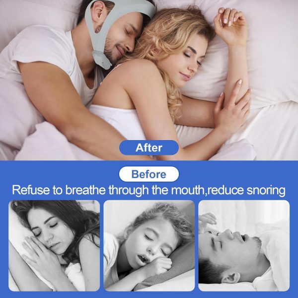Anti Snoring Chin Strap,Chin Strap For Cpap Users Adjustable And Breathable Chin Strap Provide The Effective Snoring Solution To Stop Snoring Sleep Aid Snore Reducing Aid For Woman And Men.