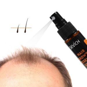 Activehair Hair Growth Spray , Ginger Hair Spray For Hair Growth