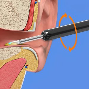 Earbit 3000 - Ear Cleaning Tool With A Camera