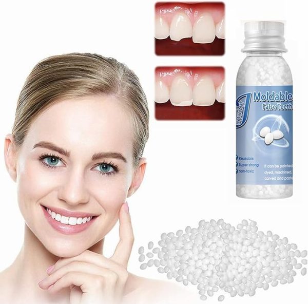 Diy Tooth Repair Kit